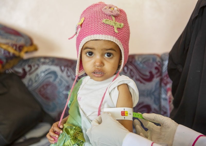 Građani i tvrtke donirali više od 1.400.000 kuna za djecu Jemena