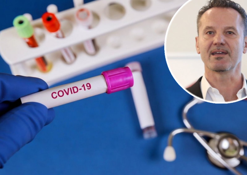 Igor Štagljar na pragu velikog otkrića: Za šest mjeseci imat ćemo imunološki test na koronavirus