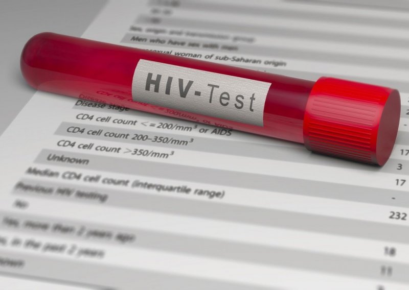 Svjetski dan borbe protiv AIDS-a: U Hrvatskoj niska učestalost infekcije